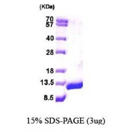 NBP1-44453